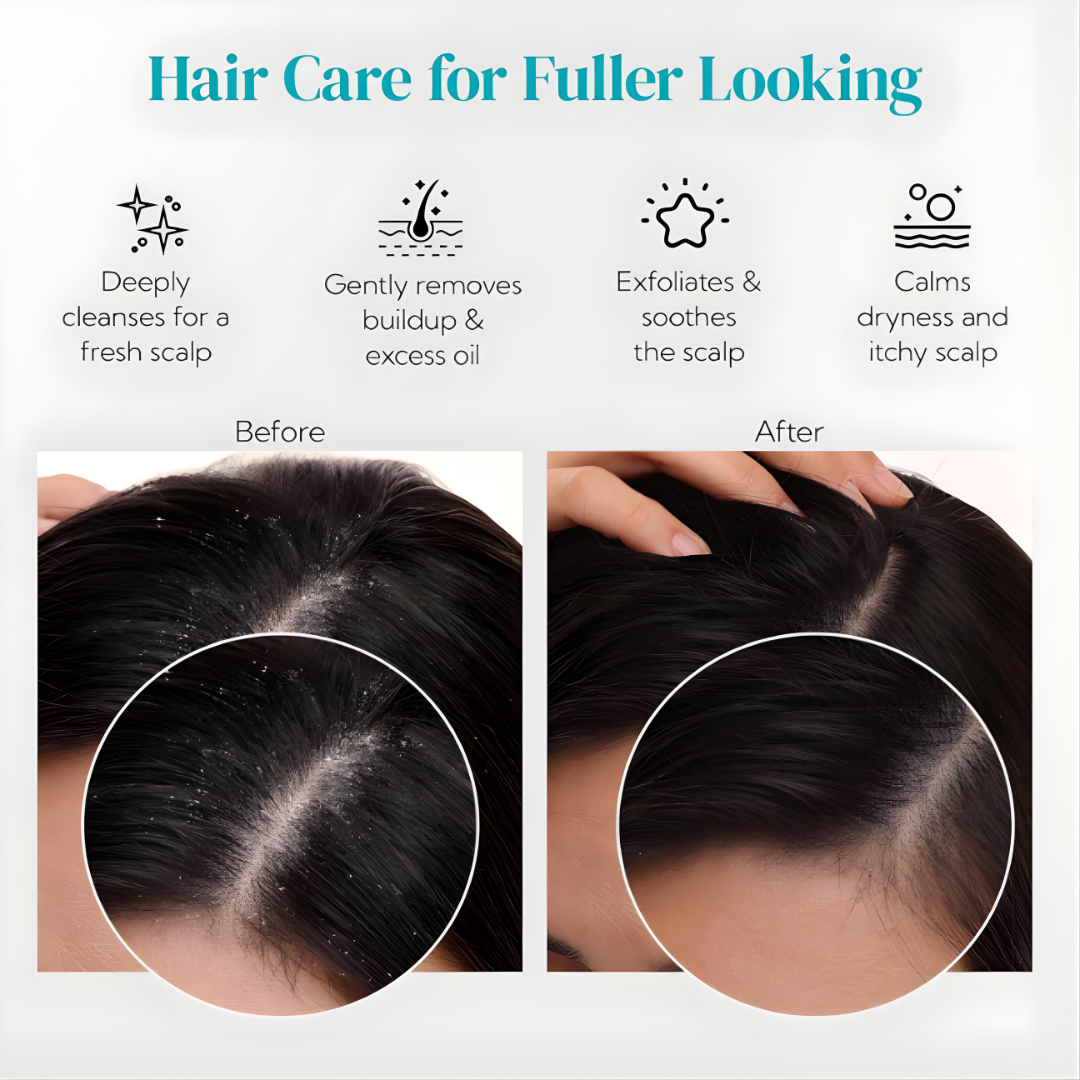 Scalp Massager Shampoo Brush with Soft Silicone Bristles - Image 6